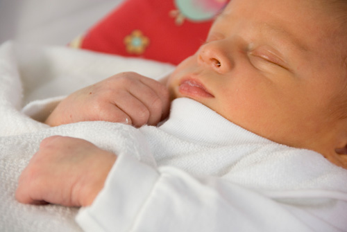 children common illnesses blue-babies jaundiced newborn